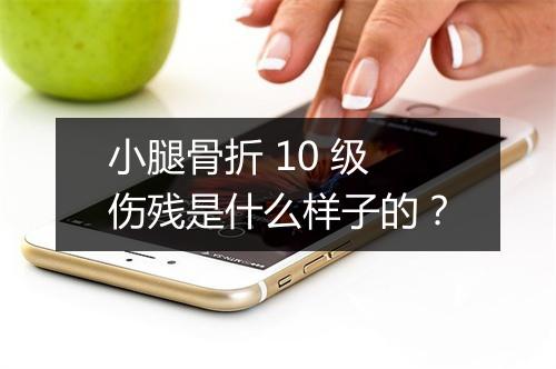 小腿骨折 10 级伤残是什么样子的？