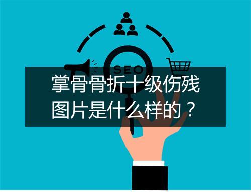掌骨骨折十级伤残图片是什么样的？