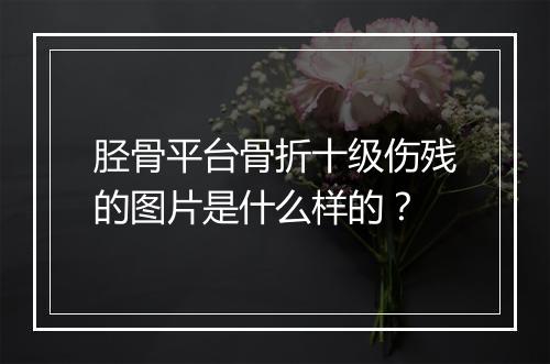胫骨平台骨折十级伤残的图片是什么样的？