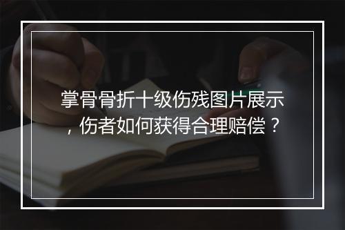 掌骨骨折十级伤残图片展示，伤者如何获得合理赔偿？