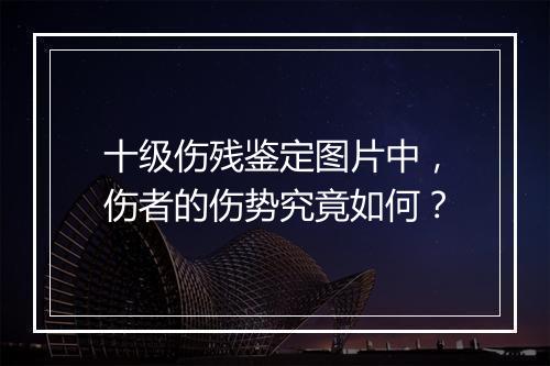 十级伤残鉴定图片中，伤者的伤势究竟如何？