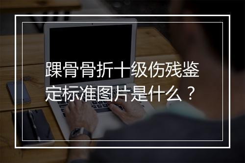 踝骨骨折十级伤残鉴定标准图片是什么？