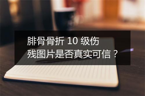 腓骨骨折 10 级伤残图片是否真实可信？