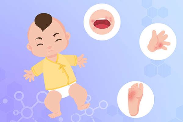 手口足病一般几天能好 怎么预防手口足病